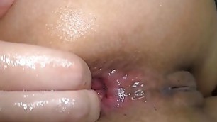 Extreme anal prolapse Fisting Helena Moeller